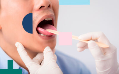 Candidiasis oral: qué es y cómo prevenirla